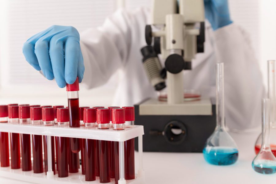 جدول تفسیر آزمایش خون + توضیح علائم اختصاری جواب آزمایش